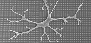 blog microglia nanostr