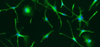 blog microglia02