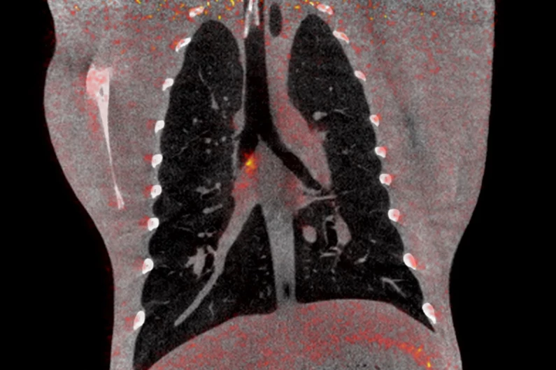 Corona vaccin onderzoek: PET-CT