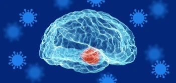 nb brainvirusalzheimer