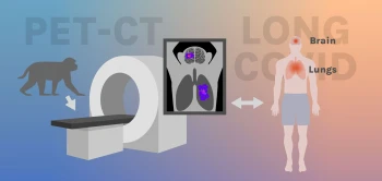 nb lcpetct