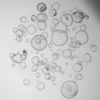 content organoid colon